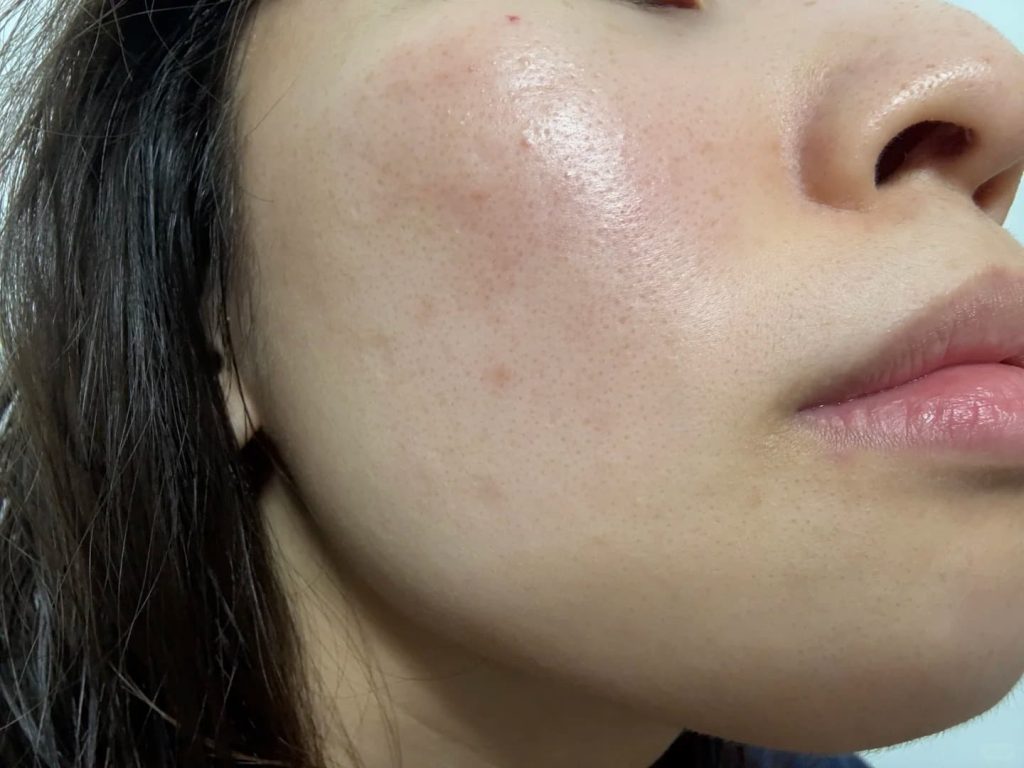 Soolantra Works Really Well